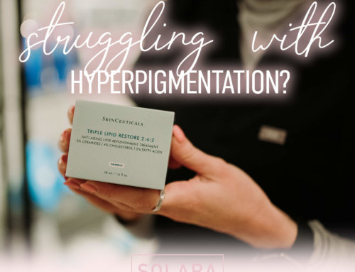 Hyperpigmentation and Balancing Masques