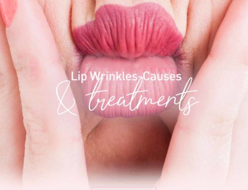 Lip Wrinkles-Causes and Treatments