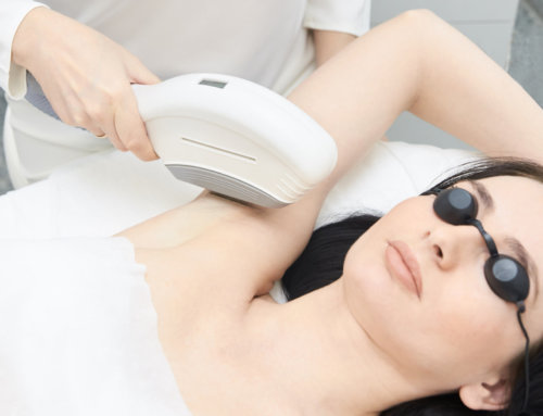 Laser Hair Removal in Anchorage, AK